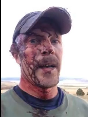 Hiker Survives Two Grizzly Bear Attacks In One Day Todd Orr | Facebook Screenshot